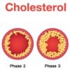 What is Cholesterol?