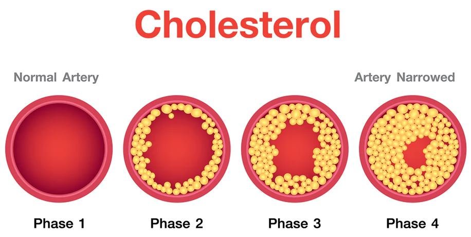 What is Cholesterol?